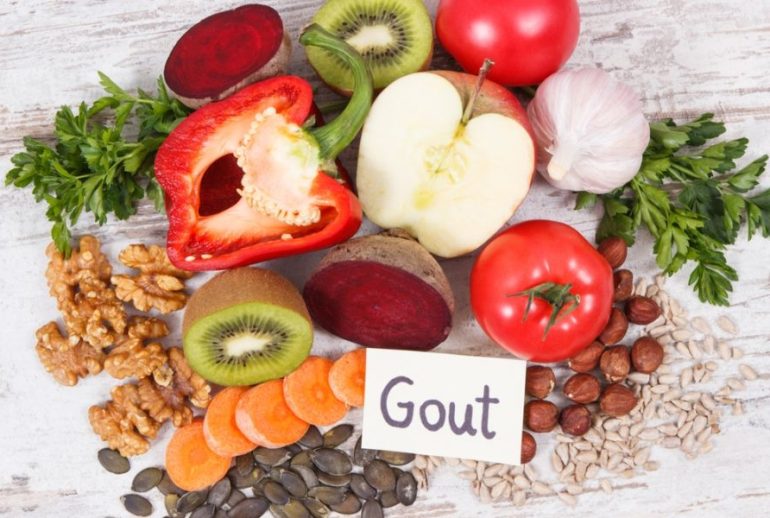 دکتر رژیم غذایی نقرس - مشهد