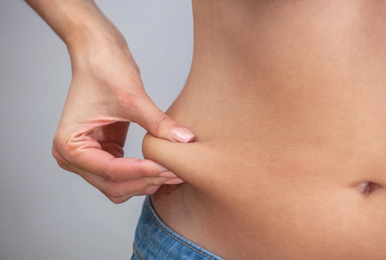 دکتر کاهش چربی بدون جراحی - اصفهان